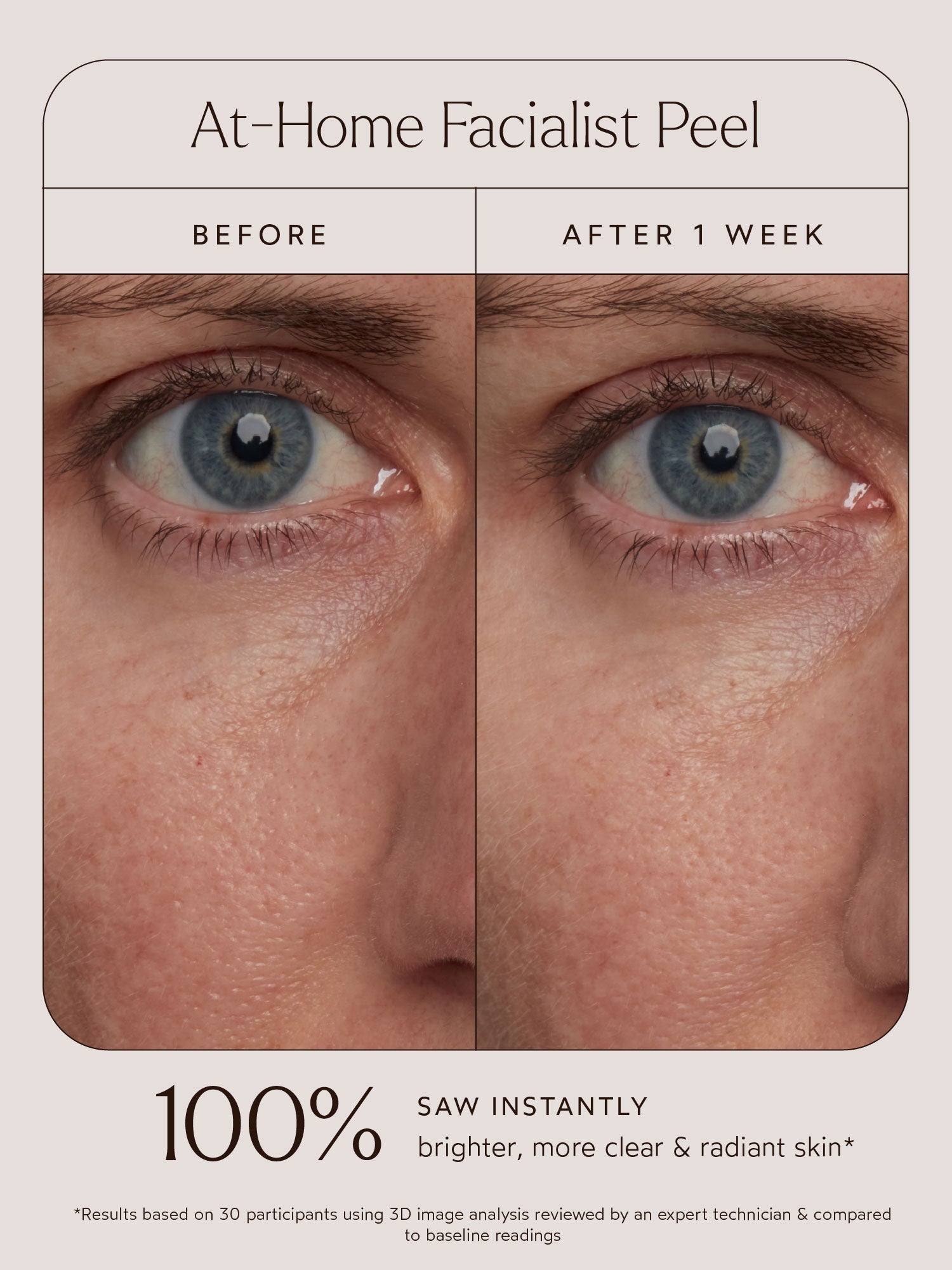 At-Home Facialist Peel
