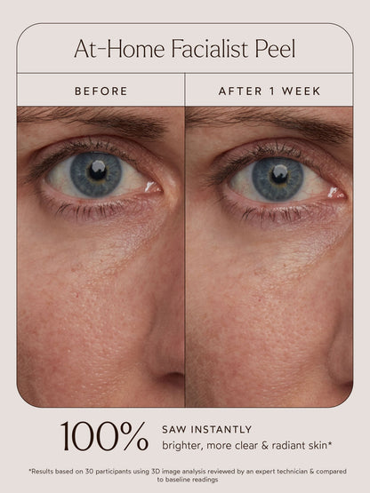 At-Home Facialist Peel