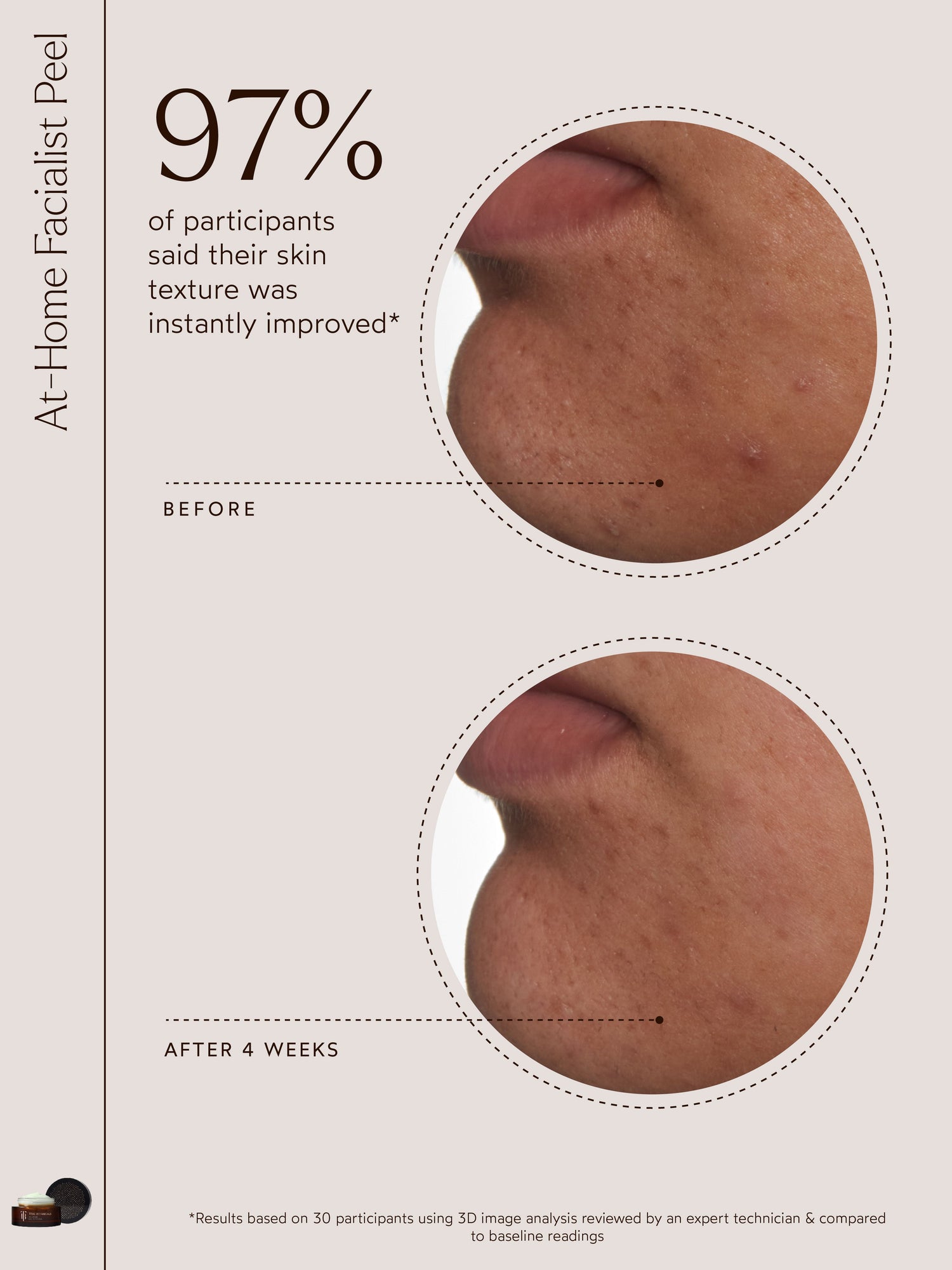 At-Home Facialist Peel