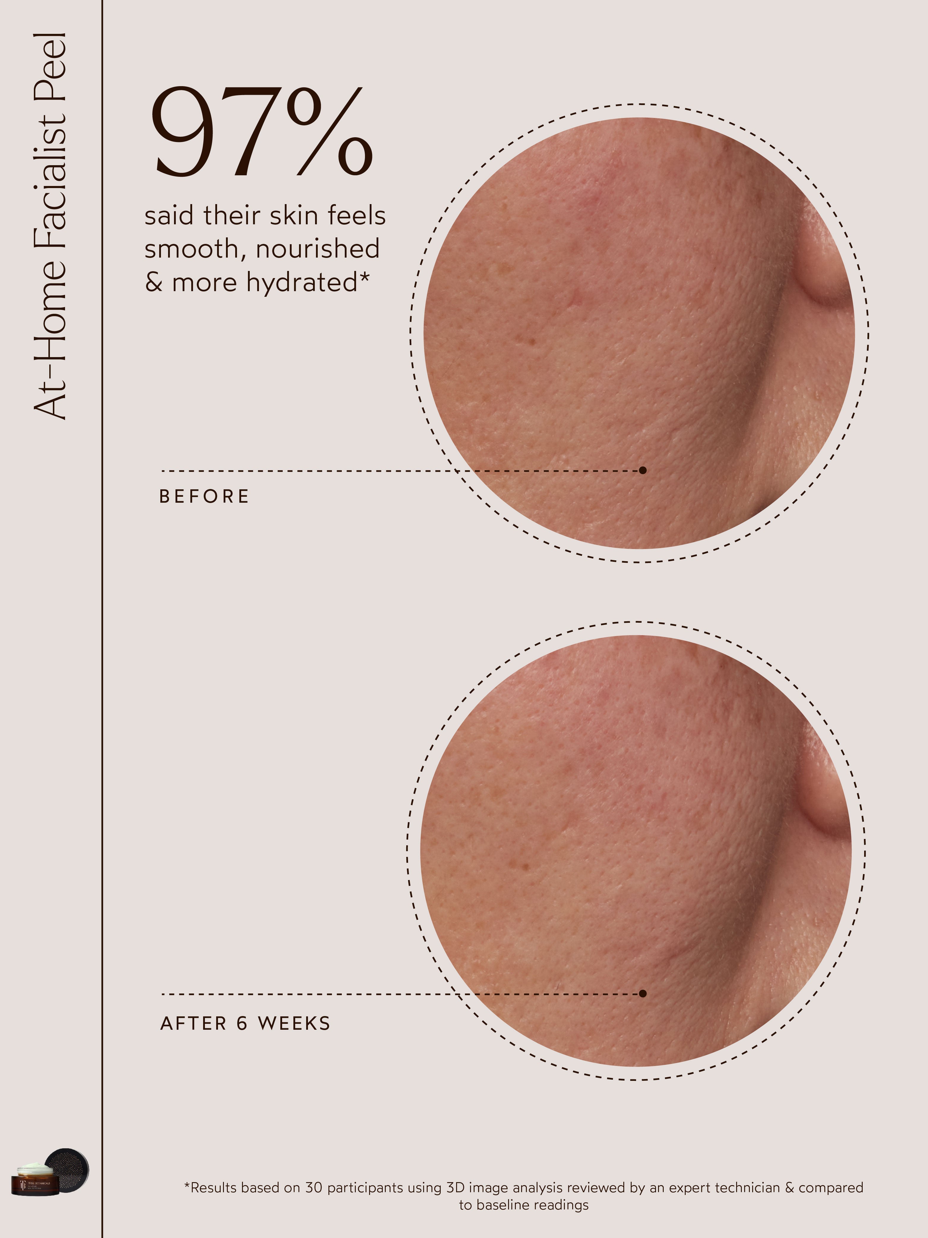 At-Home Facialist Peel