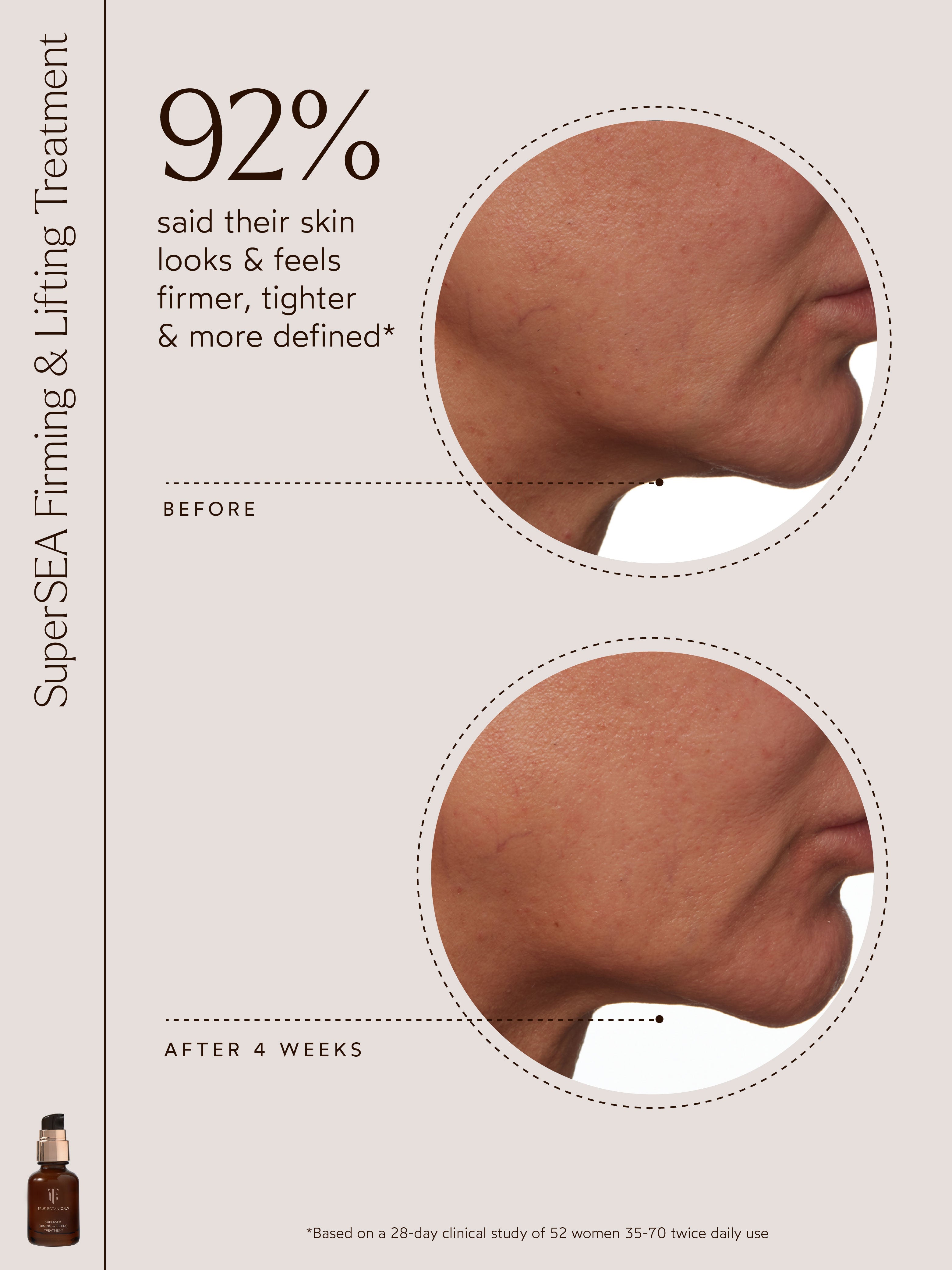 SuperSEA Firming &amp; Lifting Treatment