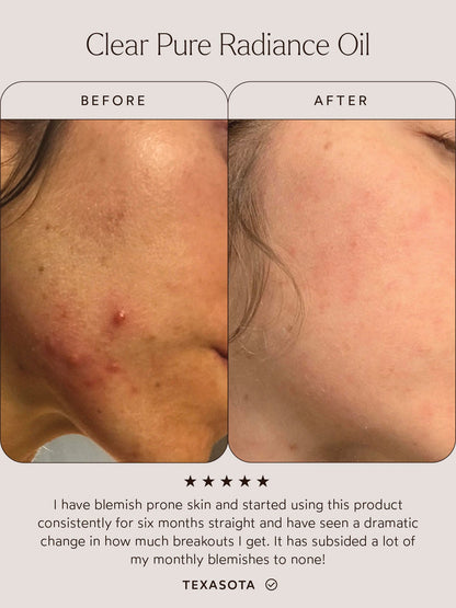 Clear Pure Radiance Oil